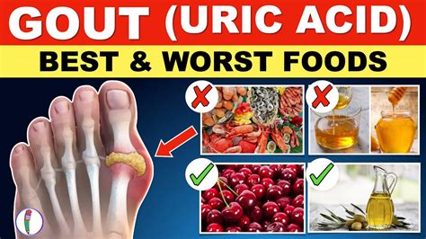 supplements to avoid with gout.